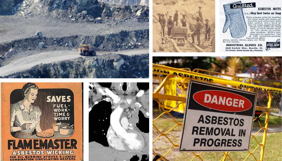 Collage showing the history of asbestos: an open-pit mine, historic asbestos workers, vintage ads for asbestos household products, protective asbestos mitts, a microscope view of asbestos fibers, and a modern warning sign for asbestos removal.